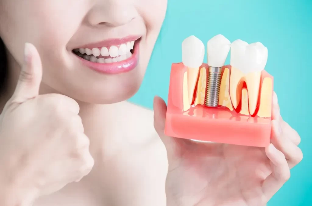 Dental Implant Placement vs. Implant Restoration: What’s the Difference?